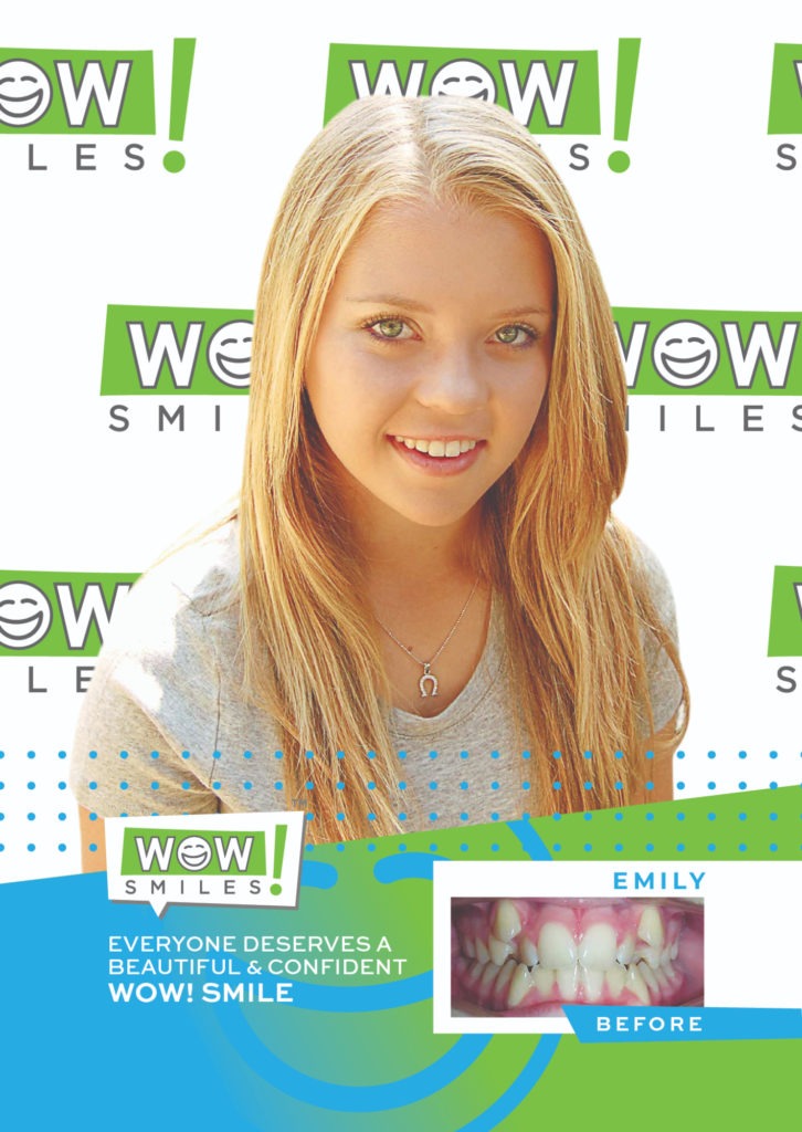 Orthodontic Before Afters Braces Invisalign Wow Smiles