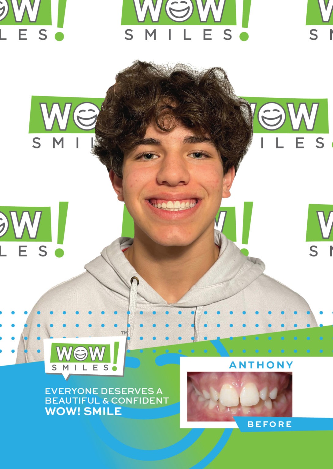 Orthodontic Before Afters Braces Invisalign Wow Smiles