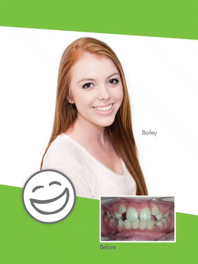 Smile Gallery Bailey