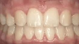 before and afters