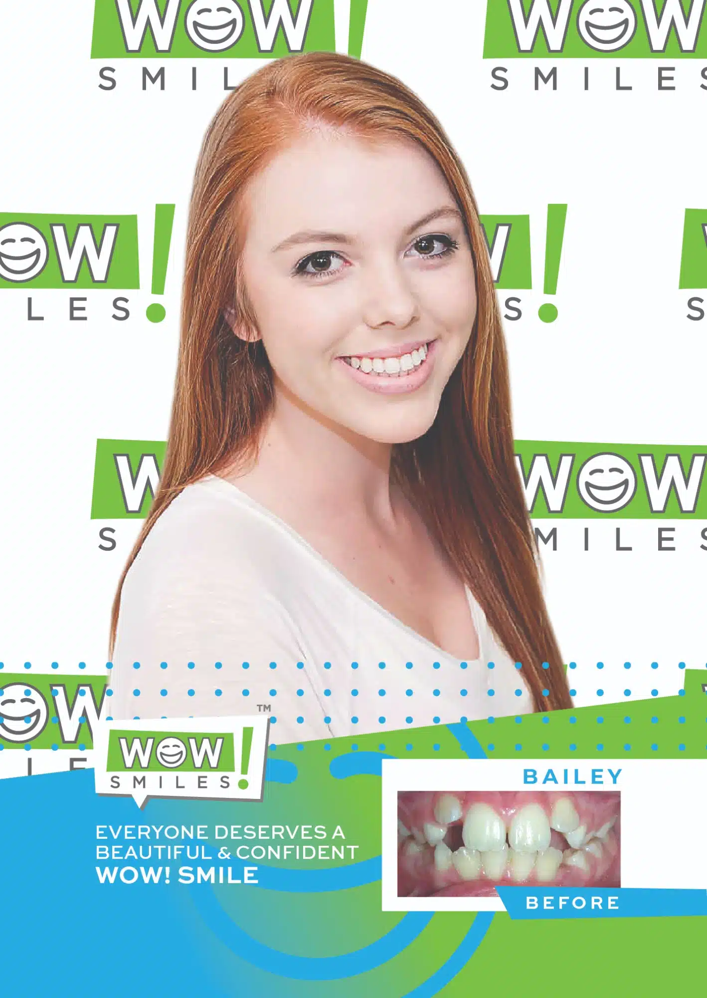 2022-05-10_Wow Smiles_Before and After Posters_Bailey_CC-01