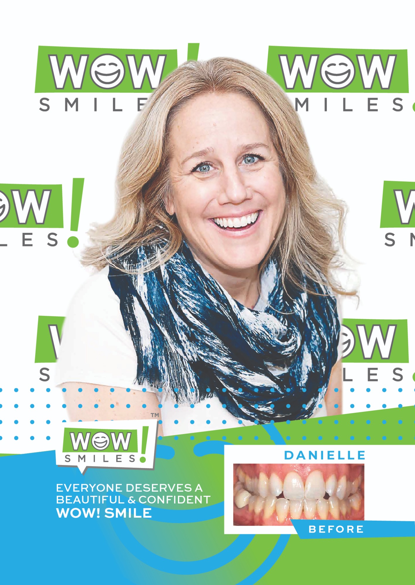 2022-05-10_Wow Smiles_Before and After Posters_Danielle_CC-01