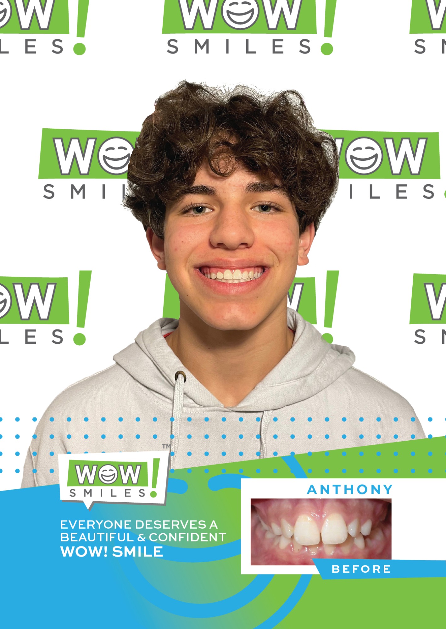 2022-07-20_Wow Smiles_Before and After Posters_Anthony_CC-01