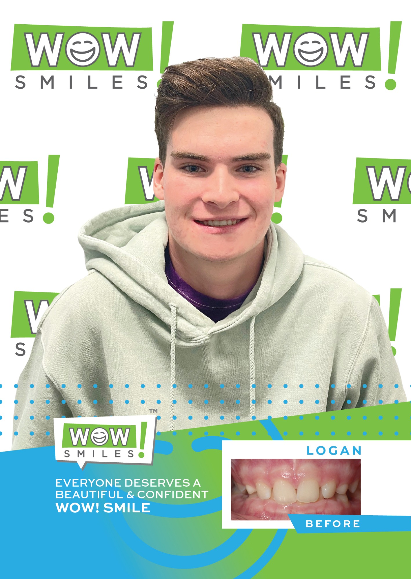 2022-07-20_Wow Smiles_Before and After Posters_Logan_CC-01