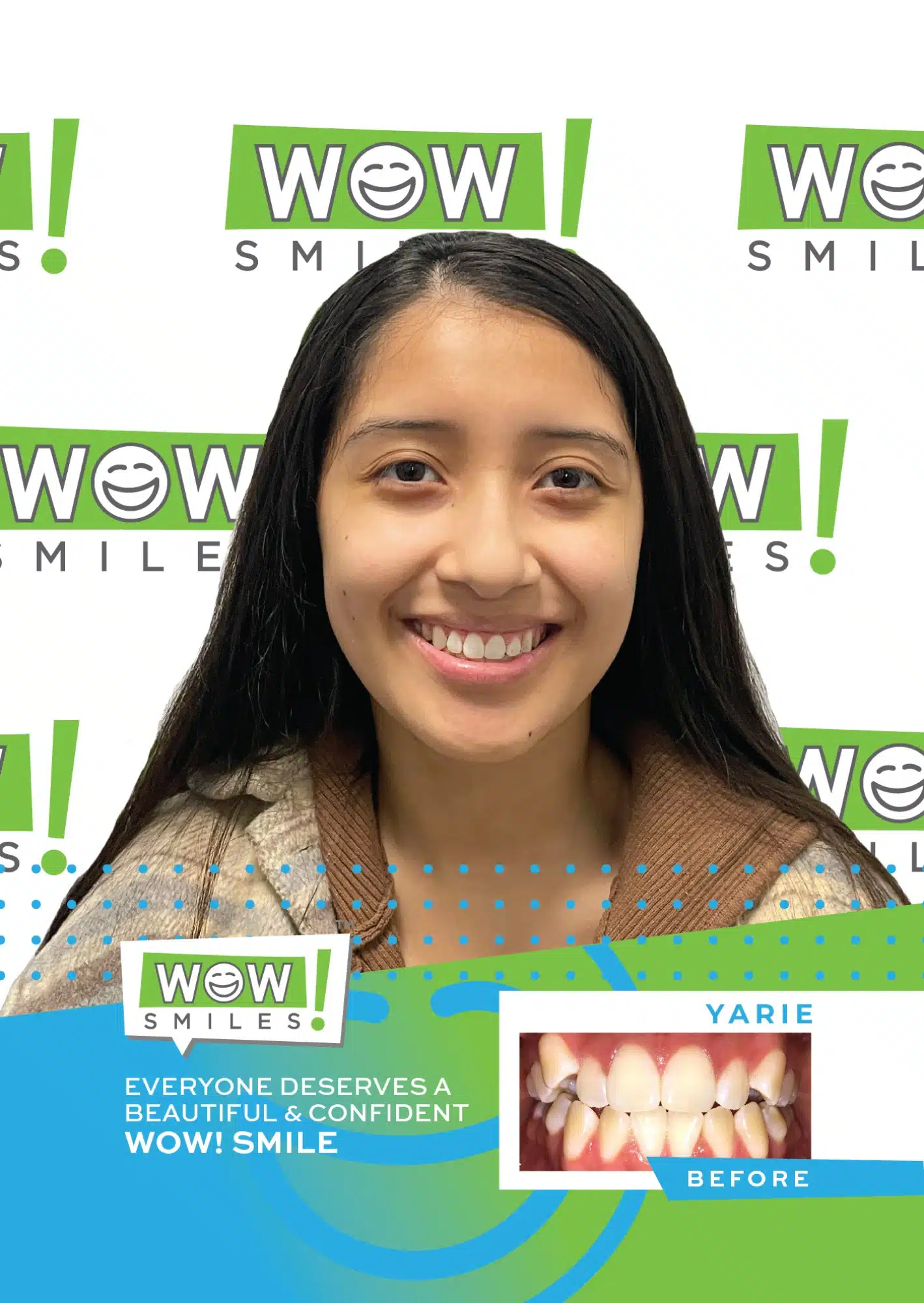 2022-07-20_Wow Smiles_Before and After Posters_Yarie_CC-01