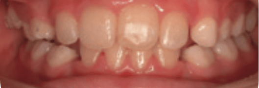 After-Phase-1-Treatment After-Phase-1-Treatment