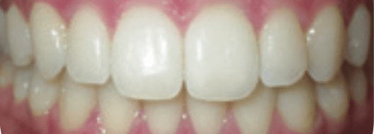After-Phase-2-Treatment After-Phase-2-Treatment