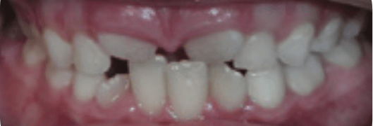 Before-Phase-1-Treatment-