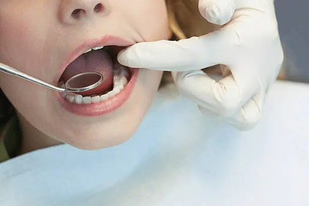 Child with mouth open and dentist holding dental mirror in mouth