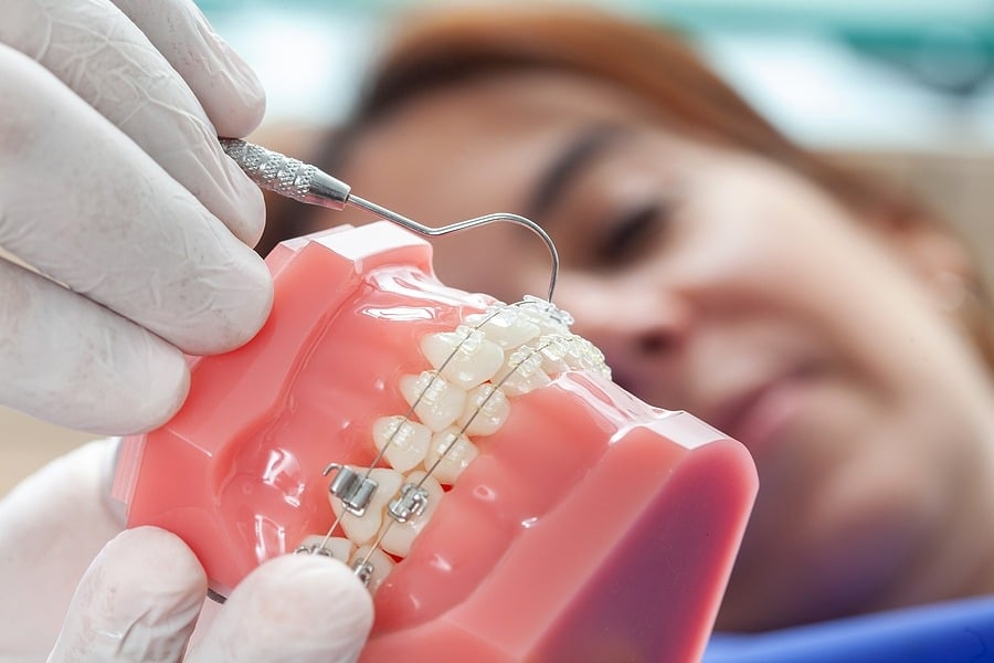 Orthodontist explaining a treatment plan with a dental model