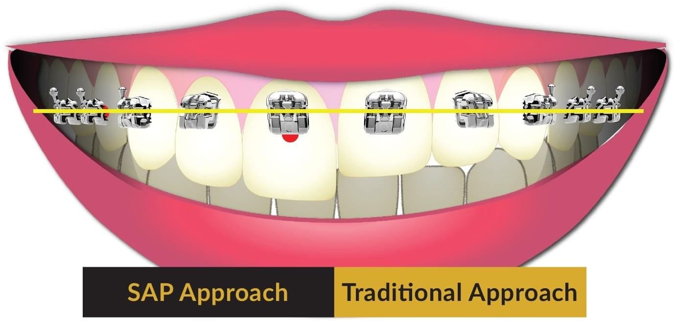 Napa Orthodontist
